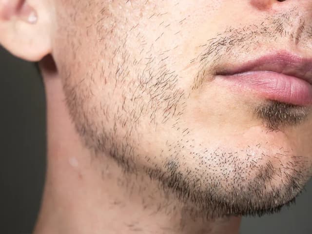 Jak mieć zarost: skuteczne sposoby na gęsty i zdrowy zarost Jak mieć zarost: skuteczne sposoby na gęsty i zdrowy zarost