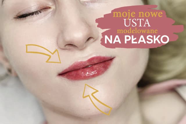 Ile kwasu hialuronowego w usta? Odkryj idealną dawkę dla siebie Ile kwasu hialuronowego w usta? Odkryj idealną dawkę dla siebie