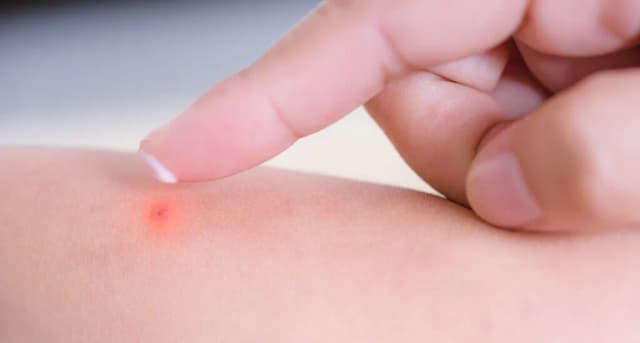 Jak pozbyć się kropek po goleniu i cieszyć się gładką skórą Jak pozbyć się kropek po goleniu i cieszyć się gładką skórą
